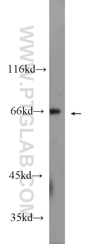 Western Blot (WB) analysis of Jurkat cells using SMN Polyclonal antibody (22330-1-AP)