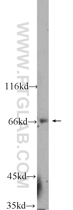 Western Blot (WB) analysis of HepG2 cells using SMN Polyclonal antibody (22330-1-AP)