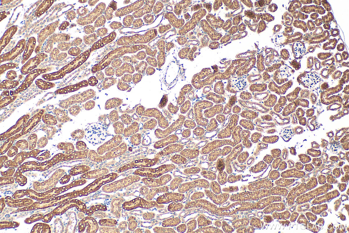 Immunohistochemistry (IHC) staining of mouse kidney tissue using SMN (Human-Specific) Monoclonal antibody (60154-1-Ig)