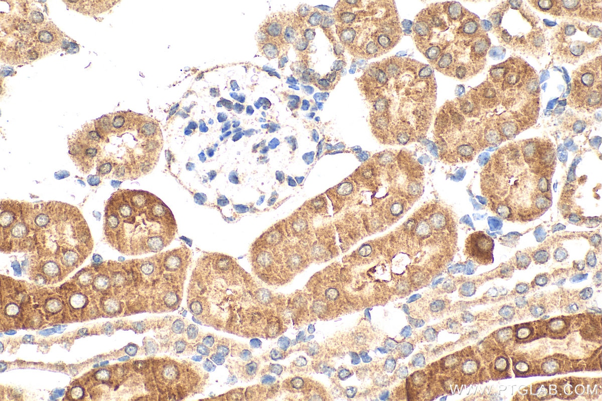 Immunohistochemistry (IHC) staining of mouse kidney tissue using SMN (Human-Specific) Monoclonal antibody (60154-1-Ig)