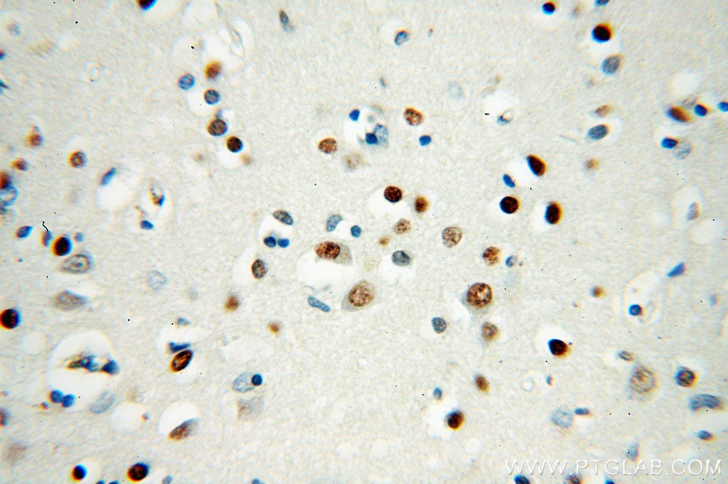Immunohistochemistry (IHC) staining of human brain tissue using SMN (Human-Specific) Monoclonal antibody (60154-1-Ig)