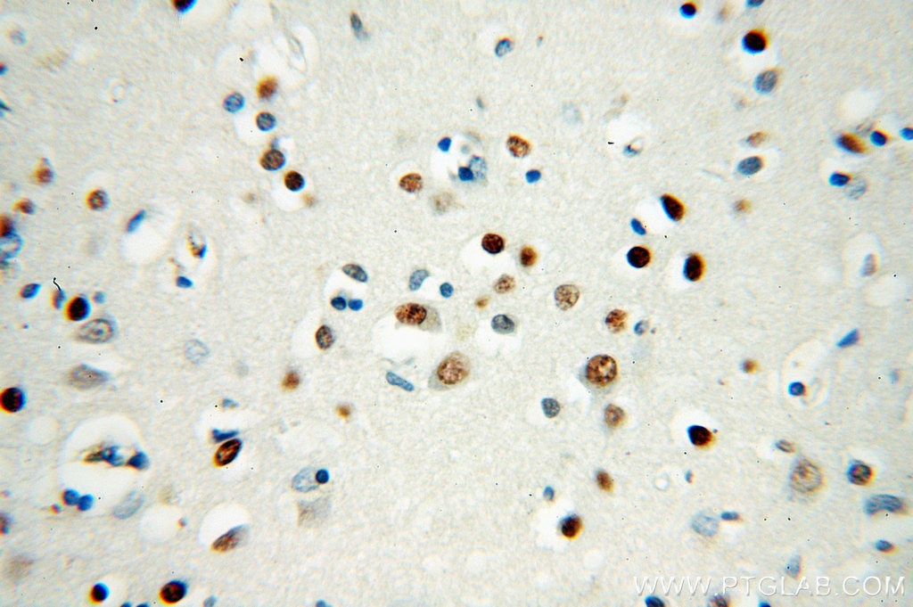 IHC staining of human brain using 60154-1-Ig