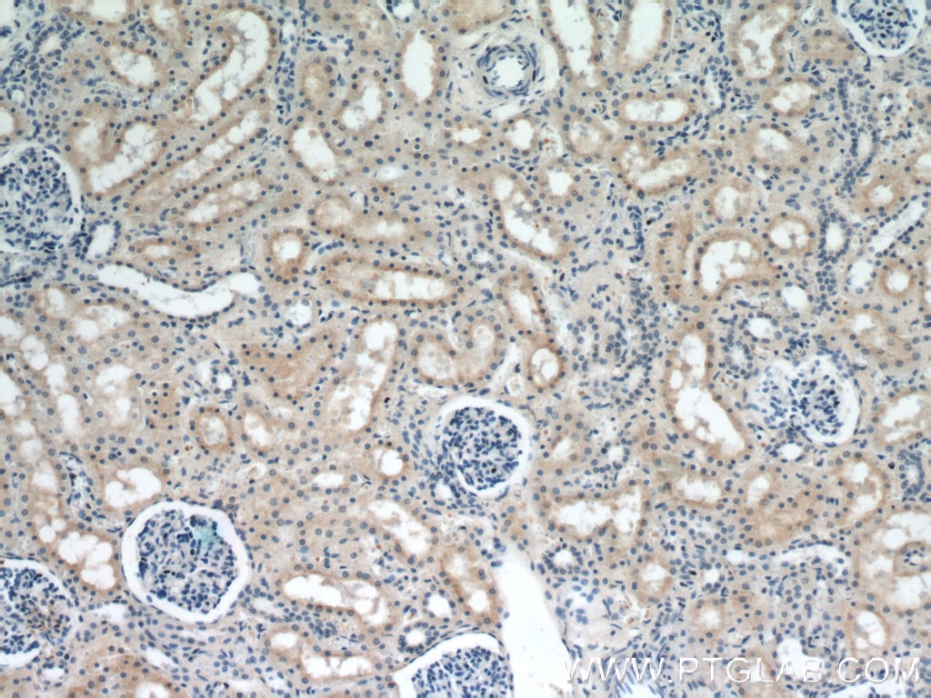 Immunohistochemistry (IHC) staining of human kidney tissue using SMN (Human-Specific) Monoclonal antibody (60154-1-Ig)