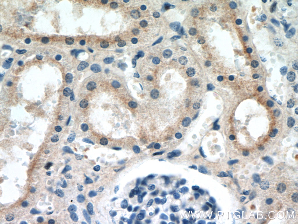 Immunohistochemistry (IHC) staining of human kidney tissue using SMN (Human-Specific) Monoclonal antibody (60154-1-Ig)