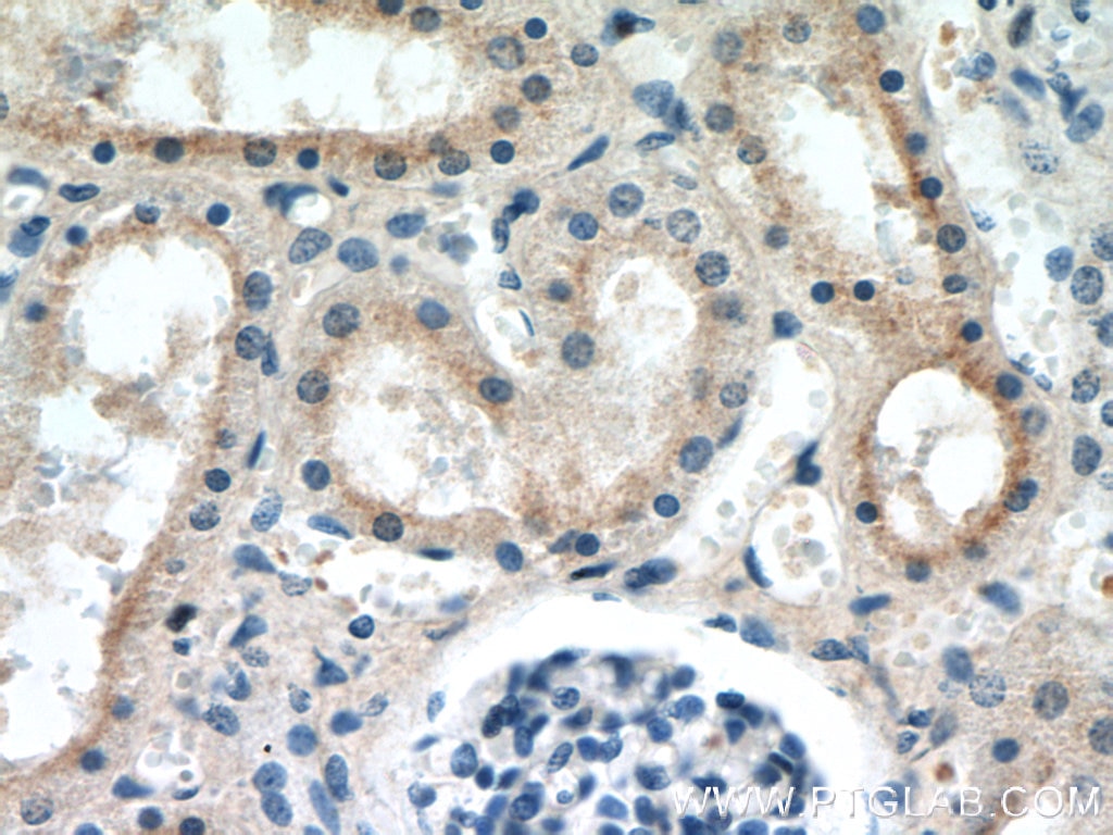 IHC staining of human kidney using 60154-1-Ig