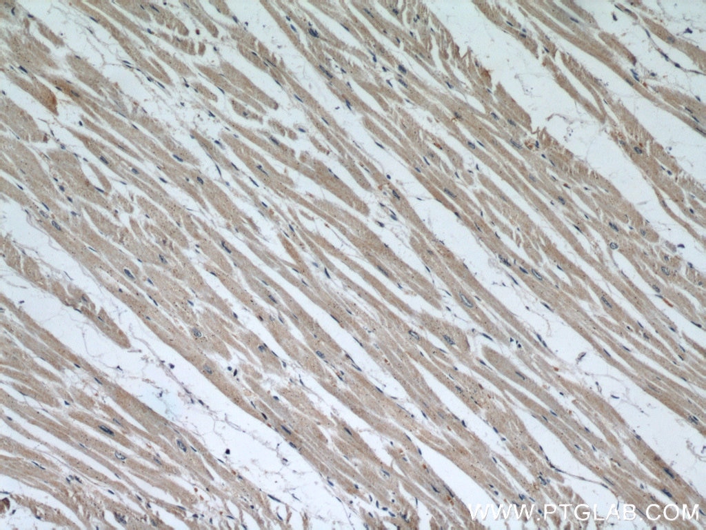 Immunohistochemistry (IHC) staining of human heart tissue using SMN (Human-Specific) Monoclonal antibody (60154-1-Ig)