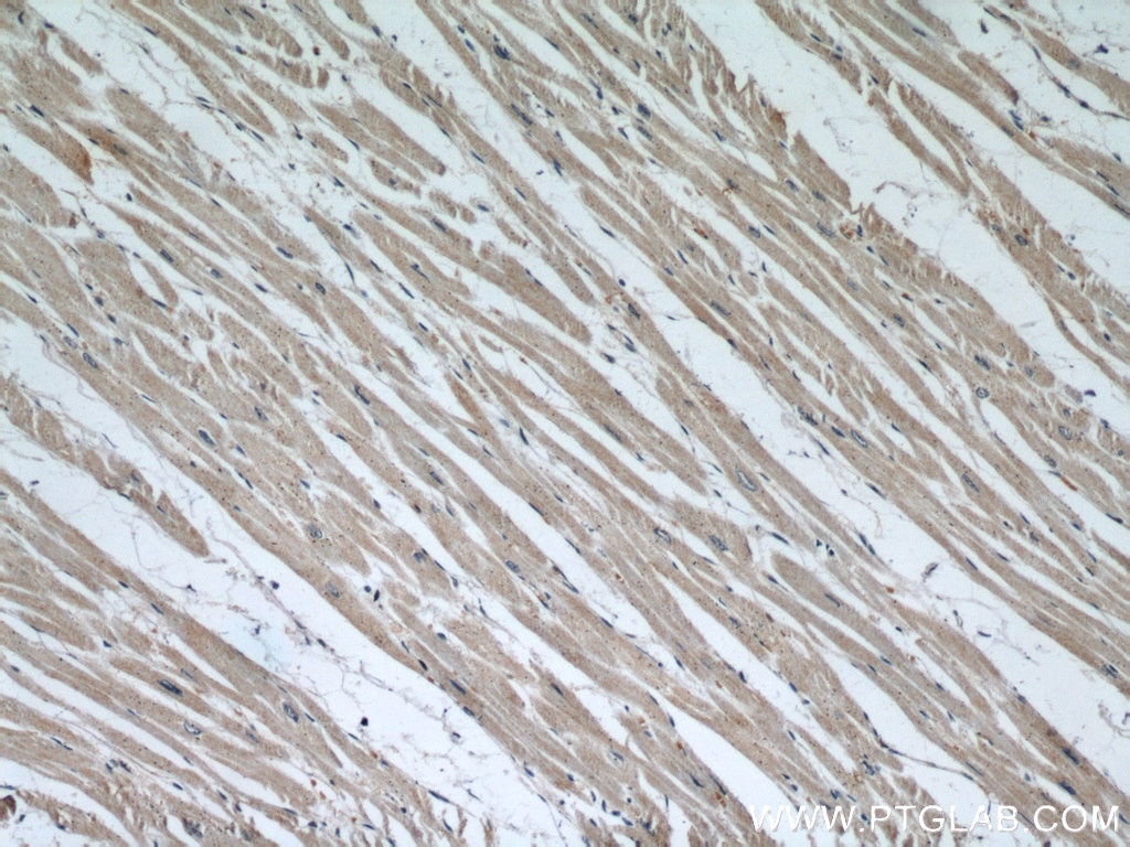 IHC staining of human heart using 60154-1-Ig