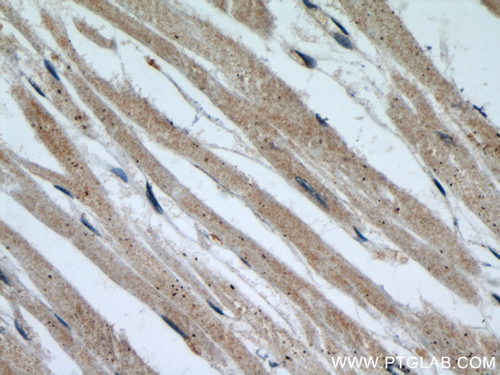 Immunohistochemistry (IHC) staining of human heart tissue using SMN (Human-Specific) Monoclonal antibody (60154-1-Ig)