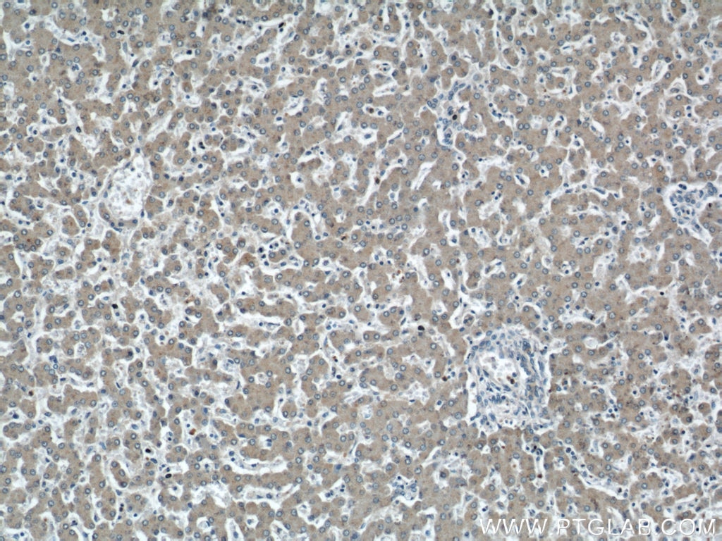 Immunohistochemistry (IHC) staining of human liver tissue using SMN (Human-Specific) Monoclonal antibody (60154-1-Ig)