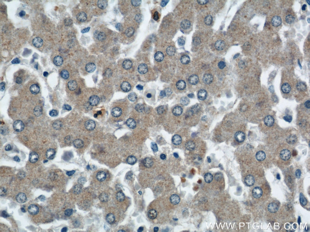 Immunohistochemistry (IHC) staining of human liver tissue using SMN (Human-Specific) Monoclonal antibody (60154-1-Ig)