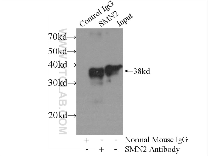Immunoprecipitation (IP) experiment of HEK-293 cells using SMN (Human-Specific) Monoclonal antibody (60154-1-Ig)