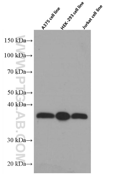 SMN (Human-Specific) Monoclonal antibody