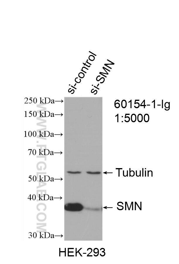 Western Blot (WB) analysis of HEK-293 cells using SMN (Human-Specific) Monoclonal antibody (60154-1-Ig)