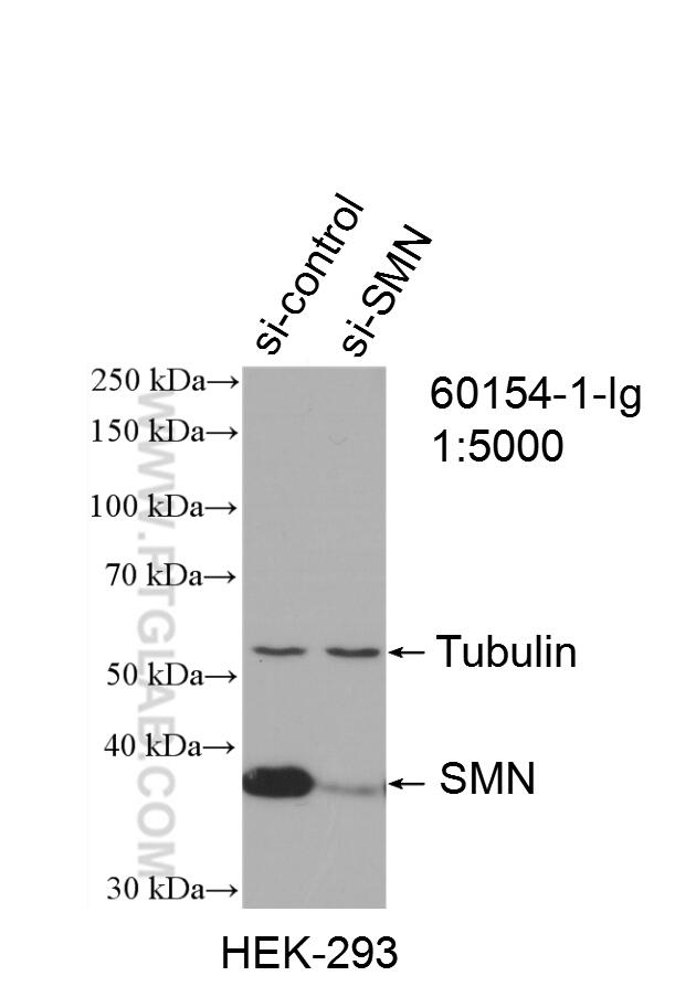WB analysis of HEK-293 using 60154-1-Ig