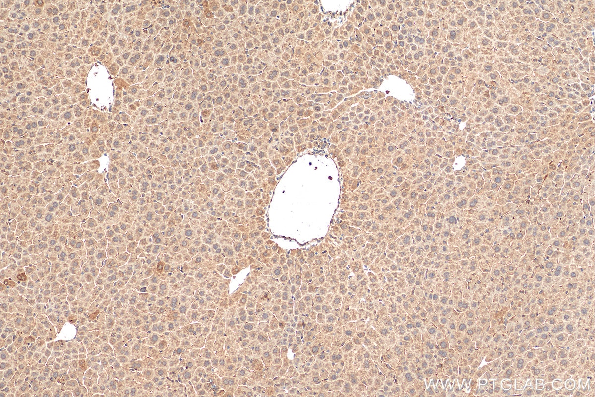 Immunohistochemistry (IHC) staining of mouse liver tissue using SMN (Human,Mouse,Rat) Monoclonal antibody (60154-2-Ig)