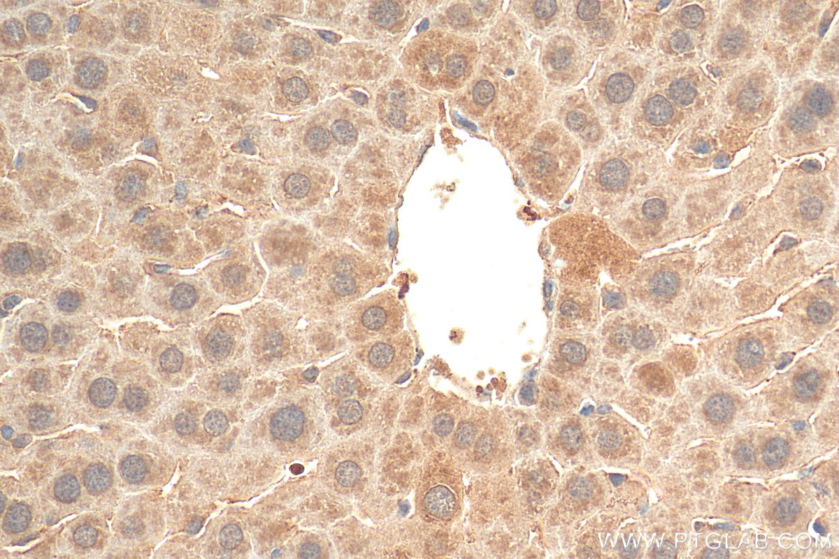 Immunohistochemistry (IHC) staining of mouse liver tissue using SMN (Human,Mouse,Rat) Monoclonal antibody (60154-2-Ig)
