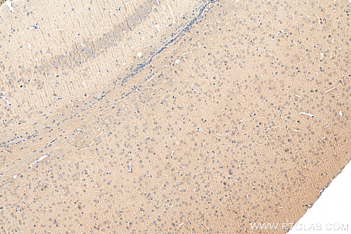 Immunohistochemistry (IHC) staining of mouse brain tissue using SMN (Human,Mouse,Rat) Monoclonal antibody (60154-2-Ig)