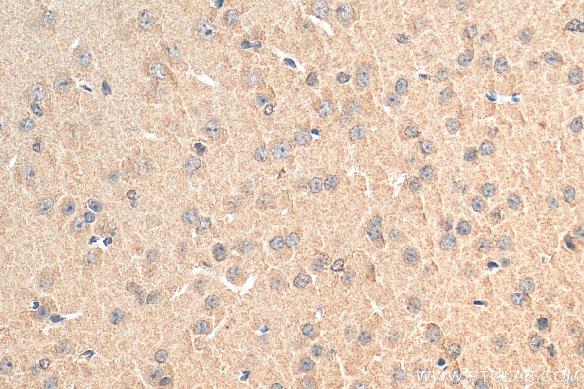 Immunohistochemistry (IHC) staining of mouse brain tissue using SMN (Human,Mouse,Rat) Monoclonal antibody (60154-2-Ig)
