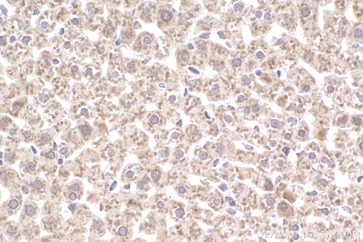 Immunohistochemistry (IHC) staining of rat liver tissue using SMN (Human,Mouse,Rat) Monoclonal antibody (60154-2-Ig)