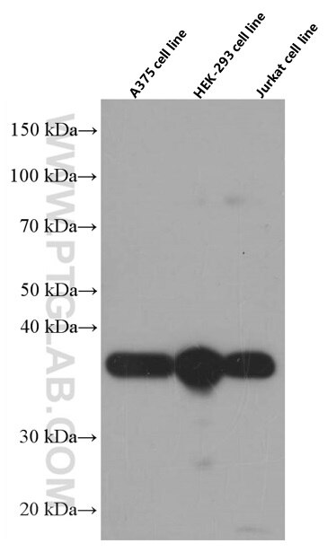 SMN (Human,Mouse,Rat) Monoclonal antibody