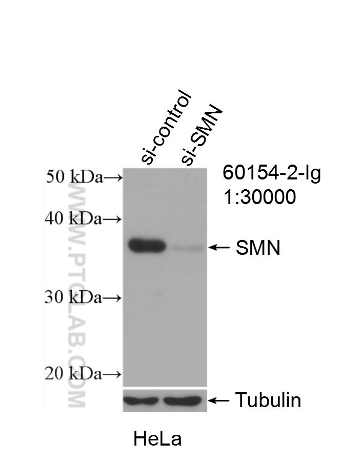 Western Blot (WB) analysis of HeLa cells using SMN (Human,Mouse,Rat) Monoclonal antibody (60154-2-Ig)