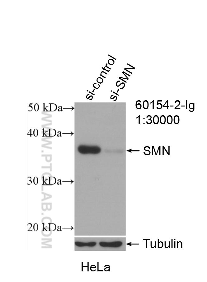 WB analysis of HeLa using 60154-2-Ig