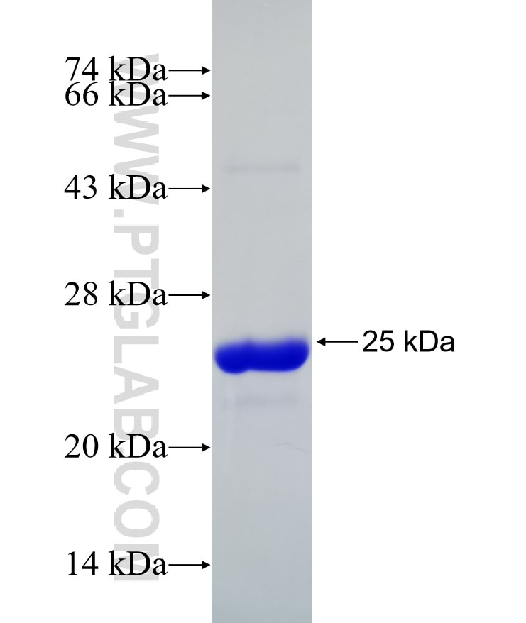 SMN2 fusion protein Ag17796 SDS-PAGE