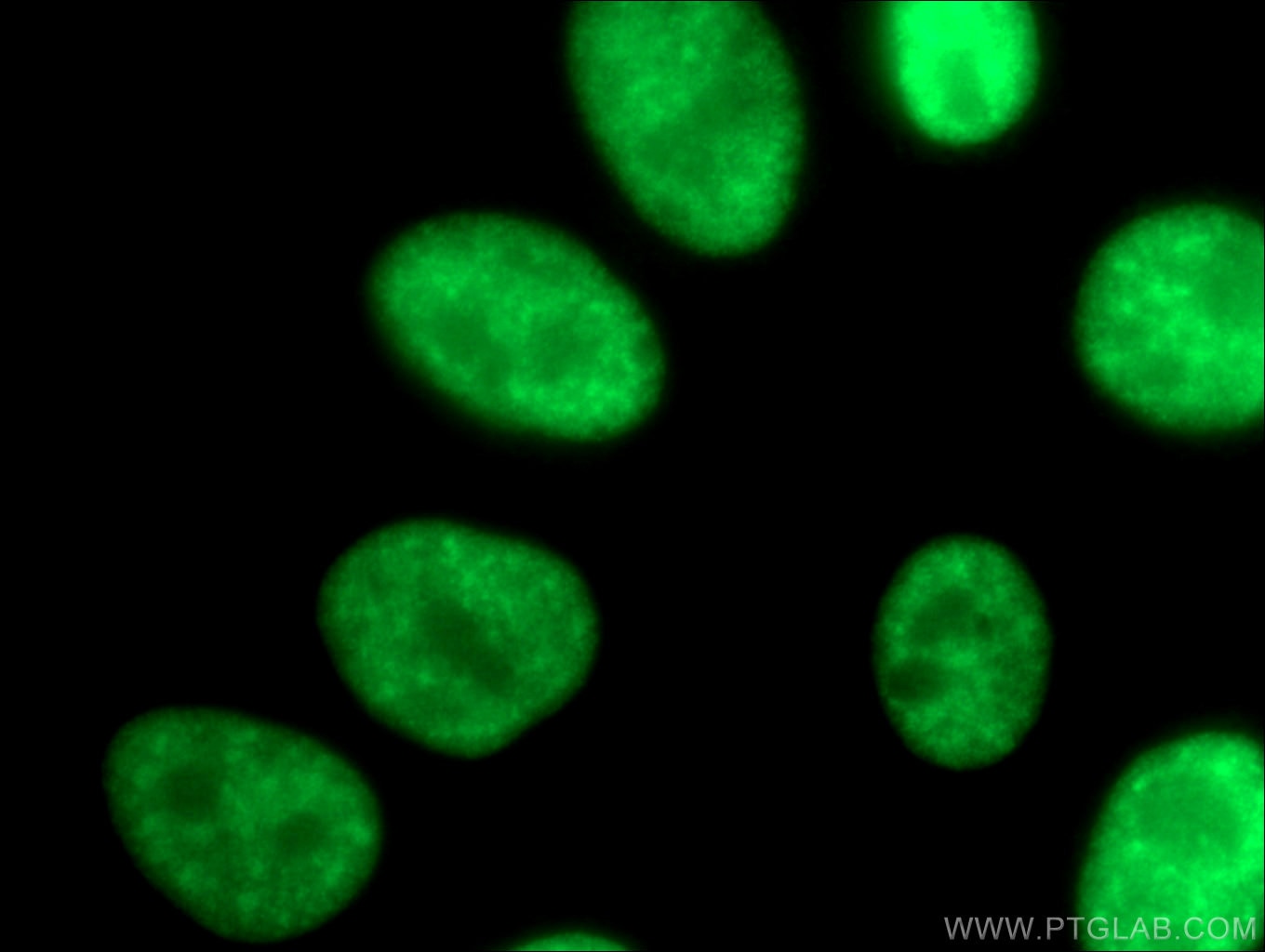 Immunofluorescence (IF) / fluorescent staining of HepG2 cells using SMNDC1 Polyclonal antibody (12178-1-AP)