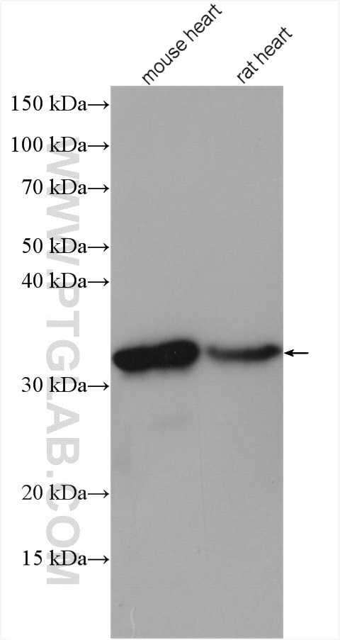 Western Blot (WB) analysis of various lysates using SMNDC1 Polyclonal antibody (12178-1-AP)