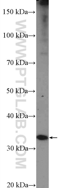 Western Blot (WB) analysis of mouse heart tissue using SMNDC1 Polyclonal antibody (12178-1-AP)