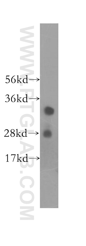 Western Blot (WB) analysis of human heart tissue using SMNDC1 Polyclonal antibody (12178-1-AP)