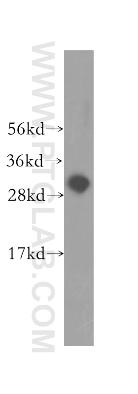 Western Blot (WB) analysis of human lung tissue using SMNDC1 Polyclonal antibody (12178-1-AP)
