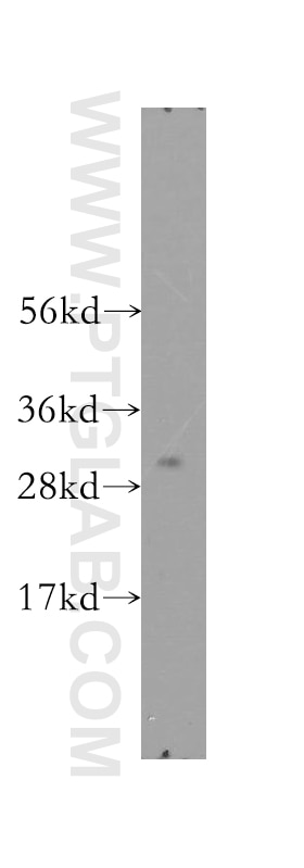 Western Blot (WB) analysis of human liver tissue using SMNDC1 Polyclonal antibody (12178-1-AP)