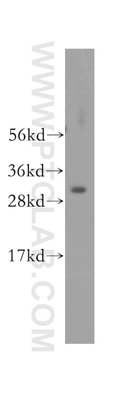 Western Blot (WB) analysis of mouse skeletal muscle tissue using SMNDC1 Polyclonal antibody (12178-1-AP)