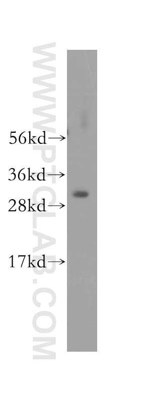 WB analysis of mouse skeletal muscle using 12178-1-AP