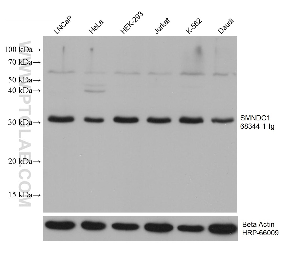 WB analysis using 68344-1-Ig