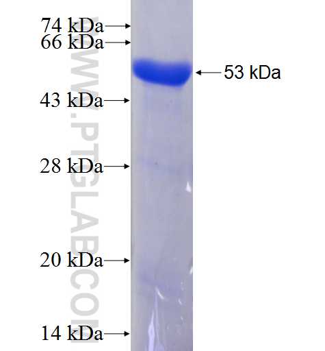 SMNDC1 fusion protein Ag2822 SDS-PAGE