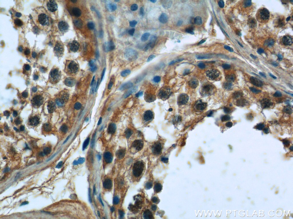 SMO Polyclonal antibody