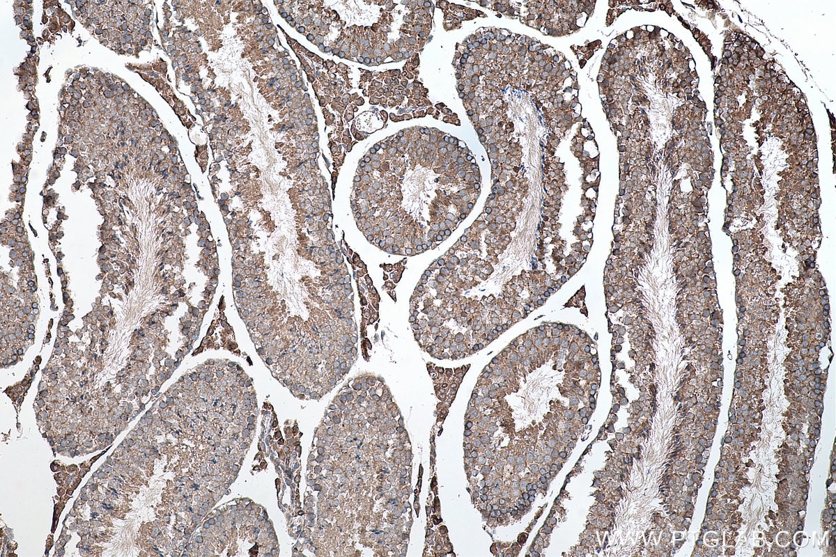 Immunohistochemistry (IHC) staining of mouse testis tissue using SMO Polyclonal antibody (20787-1-AP)