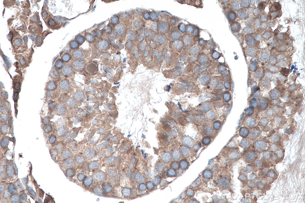 Immunohistochemistry (IHC) staining of mouse testis tissue using SMO Polyclonal antibody (20787-1-AP)
