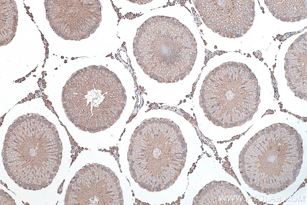 Immunohistochemistry (IHC) staining of rat testis tissue using SMO Polyclonal antibody (20787-1-AP)