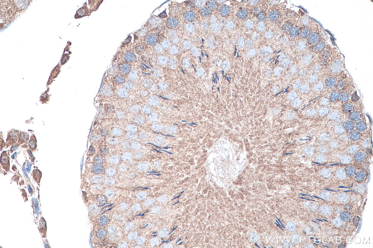 Immunohistochemistry (IHC) staining of rat testis tissue using SMO Polyclonal antibody (20787-1-AP)