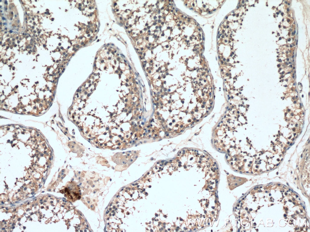 Immunohistochemistry (IHC) staining of human testis tissue using SMO Polyclonal antibody (20787-1-AP)