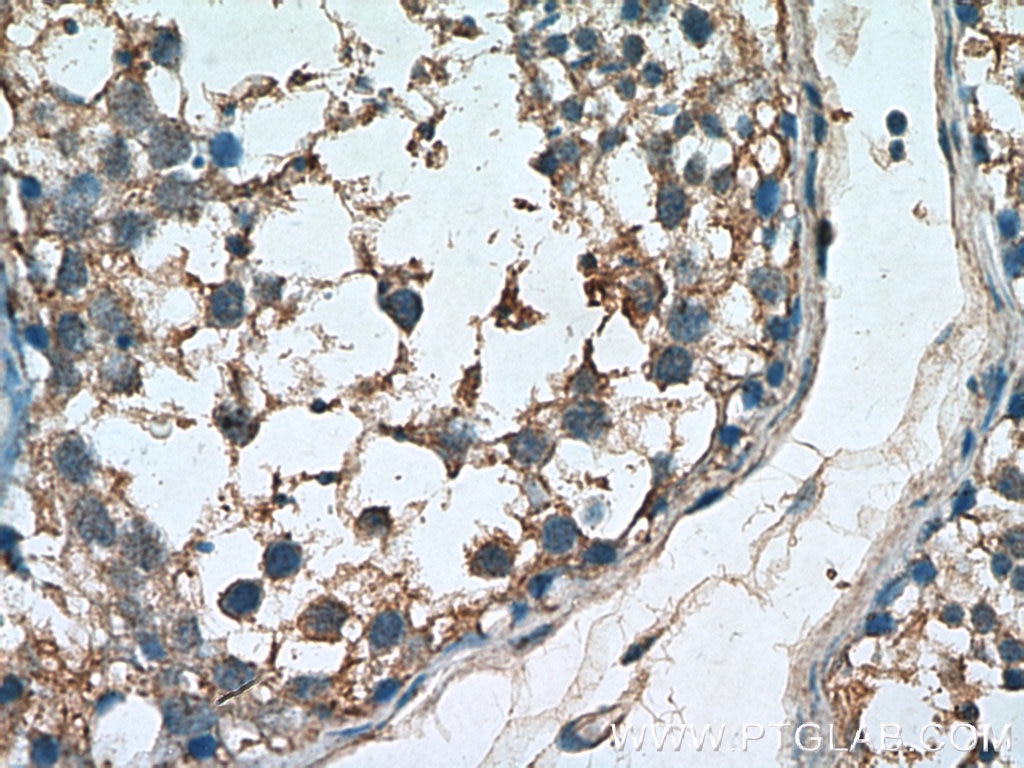 Immunohistochemistry (IHC) staining of human testis tissue using SMO Polyclonal antibody (20787-1-AP)