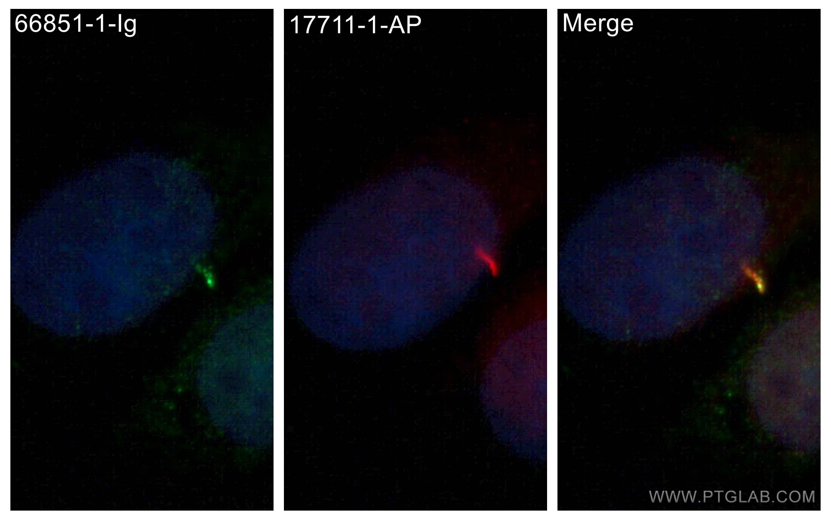 Immunofluorescence (IF) / fluorescent staining of MDCK cells using SMO Monoclonal antibody (66851-1-Ig)