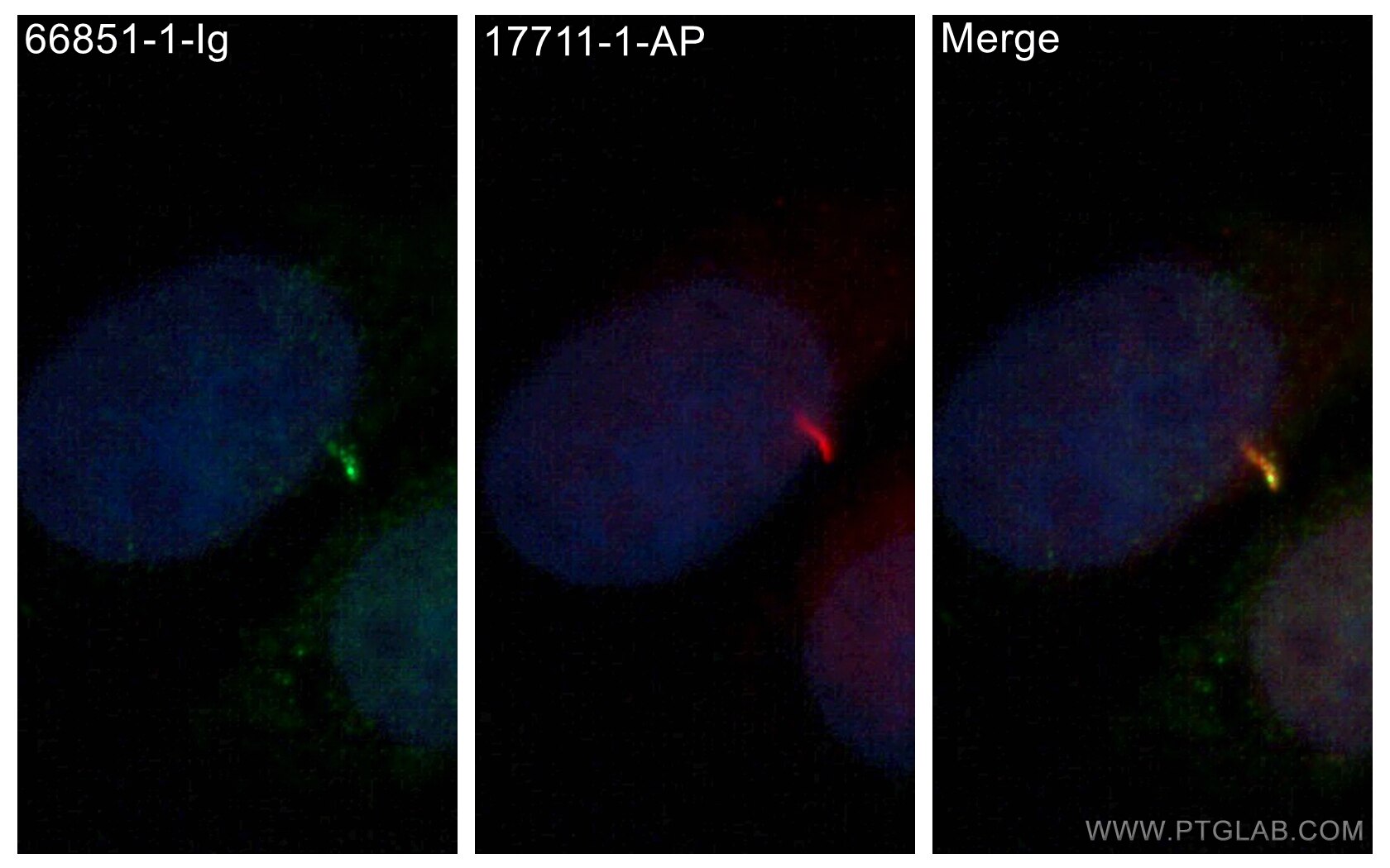 Immunofluorescence (IF) / fluorescent staining of MDCK cells using SMO Monoclonal antibody (66851-1-Ig)