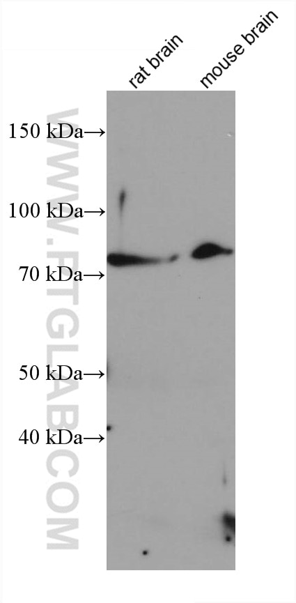 Western Blot (WB) analysis of various lysates using SMO Monoclonal antibody (66851-1-Ig)
