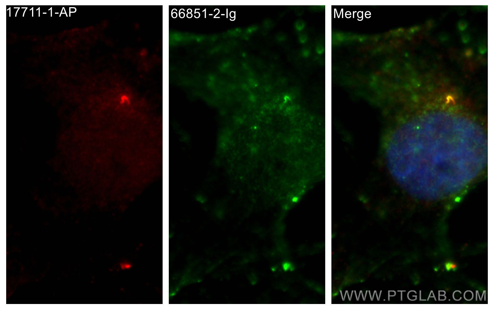 Immunofluorescence (IF) / fluorescent staining of MDCK cells using SMO Monoclonal antibody (66851-2-Ig)
