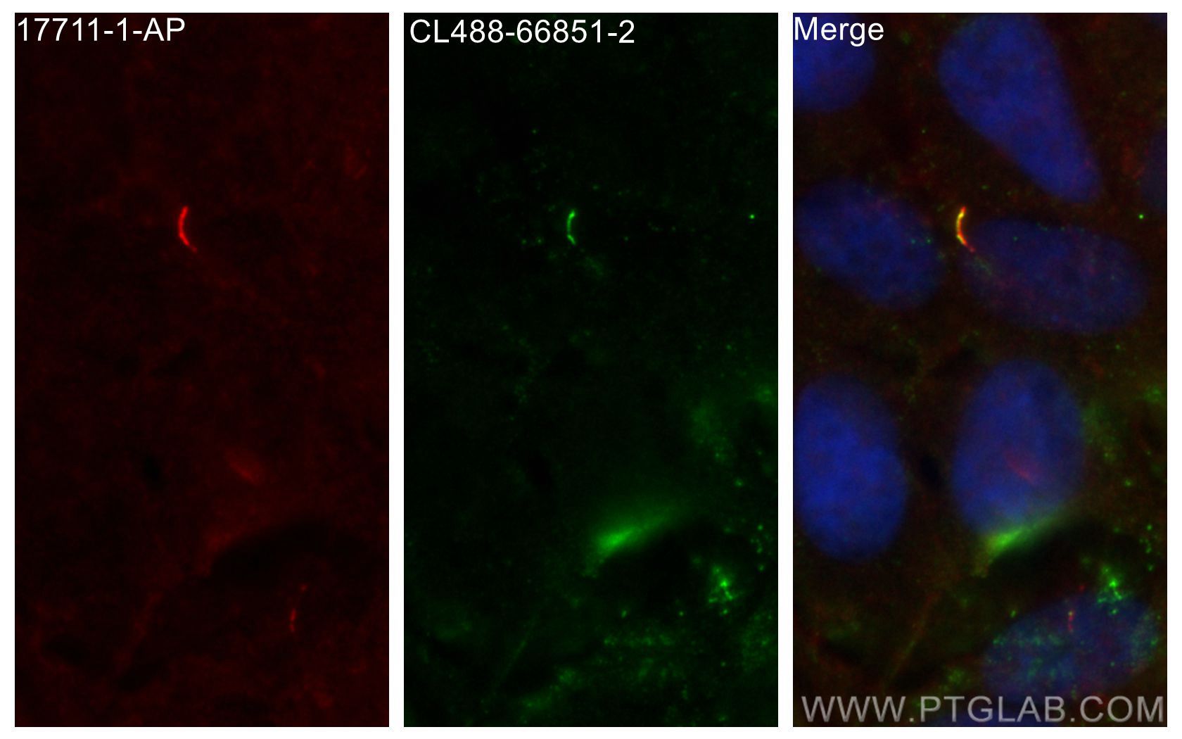 IF Staining of hTERT-RPE1 using CL488-66851-2