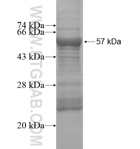 SMO fusion protein Ag14322 SDS-PAGE